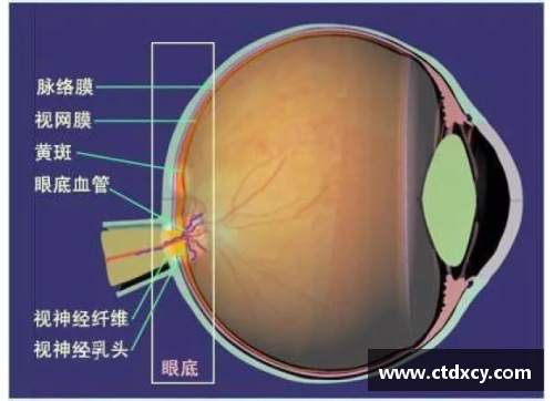 自测青光眼：眼底视网膜检查是最准确的方法